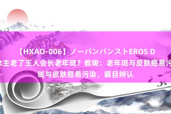 【HXAO-006】ノーパンパンストEROS DX4時間 东说念主老了王人会长老年斑？教唆：老年斑与皮肤癌易污染，瞩目辨认